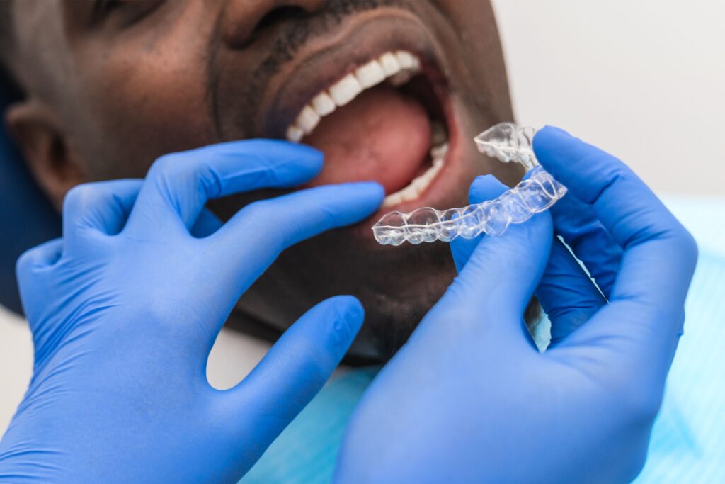 Invisalign® Treatment