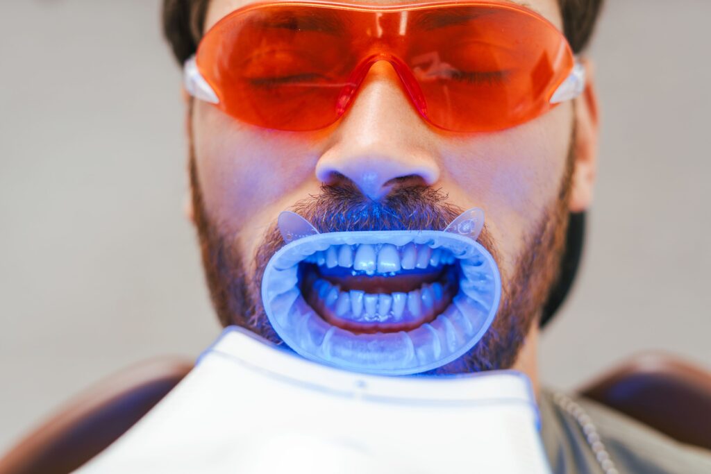 Laser Teeth Whitening