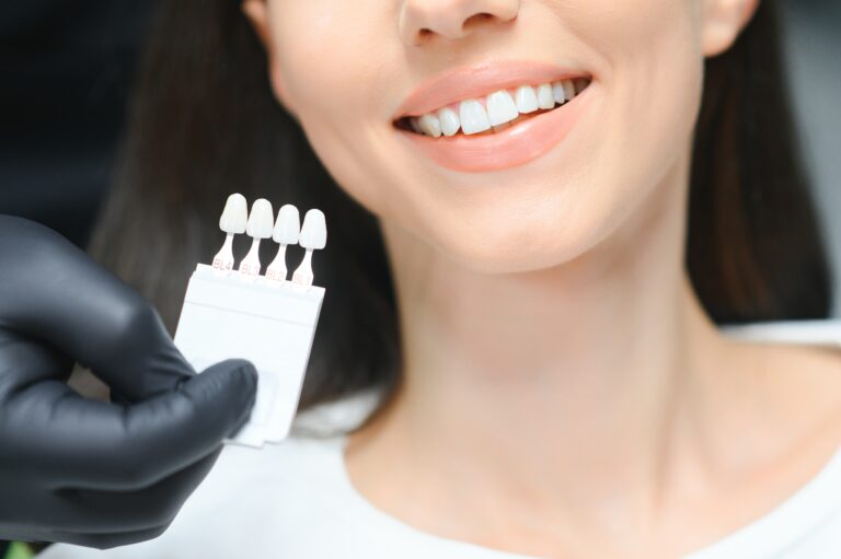 Doctor matching patient's teeth color with palette, closeup. Cosmetic dentistry