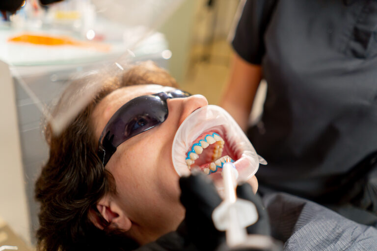close up dental up office girl dentist applies protective gel to the gums of a young guy